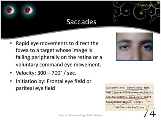 23rd July '15
74Dept. of Ophthalmology, JNMC, Belagavi
Saccades
• Rapid eye movements to direct the
fovea to a target whose image is
falling peripherally on the retina or a
voluntary command eye movement.
• Velocity: 300 – 700° / sec.
• Initiation by: Frontal eye field or
pariteal eye field
 
