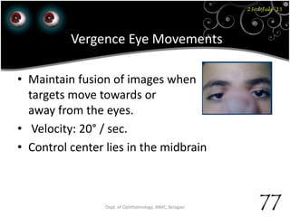 23rd July '15
77Dept. of Ophthalmology, JNMC, Belagavi
Vergence Eye Movements
• Maintain fusion of images when
targets move towards or
away from the eyes.
• Velocity: 20° / sec.
• Control center lies in the midbrain
 