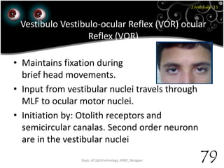 23rd July '15
79Dept. of Ophthalmology, JNMC, Belagavi
Vestibulo Vestibulo-ocular Reflex (VOR) ocular
Reflex (VOR)
• Maintains fixation during
brief head movements.
• Input from vestibular nuclei travels through
MLF to ocular motor nuclei.
• Initiation by: Otolith receptors and
semicircular canalas. Second order neuronn
are in the vestibular nuclei
 
