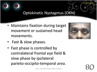 23rd July '15
80Dept. of Ophthalmology, JNMC, Belagavi
Optokinetic Nystagmus (OKN)
• Maintains fixation during target
movement or sustained head
movements.
• Fast & slow phases.
• Fast phase is controlled by
contralateral frontal eye field &
slow phase by ipsilateral
parieto-occipito-temporal area.
 