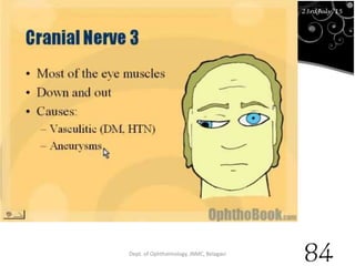 23rd July '15 Dept. of Ophthalmology, JNMC, Belagavi
84
23rdJuly '15
 