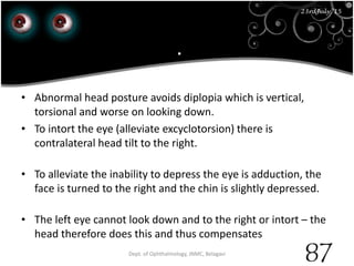.
23rd July '15 Dept. of Ophthalmology, JNMC, Belagavi
87
23rdJuly '15
• Abnormal head posture avoids diplopia which is vertical,
torsional and worse on looking down.
• To intort the eye (alleviate excyclotorsion) there is
contralateral head tilt to the right.
• To alleviate the inability to depress the eye is adduction, the
face is turned to the right and the chin is slightly depressed.
• The left eye cannot look down and to the right or intort – the
head therefore does this and thus compensates
 