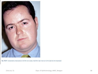 23rd July '15 Dept. of Ophthalmology, JNMC, Belagavi 88
 