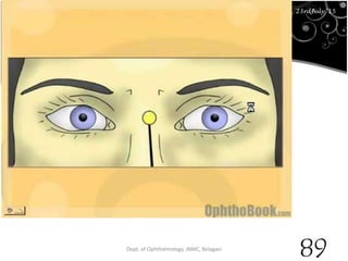 23rd July '15 Dept. of Ophthalmology, JNMC, Belagavi
89
23rdJuly '15
 