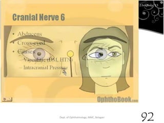 23rd July '15 Dept. of Ophthalmology, JNMC, Belagavi
92
23rdJuly '15
 
