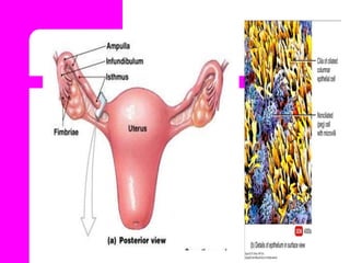 Functions of Fallopian tubes
Gamete transport (ovum pickup, ovum transport, sperm
transport).
Final maturation of gamete...