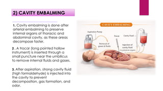 Comprehensive Study of Mrut Sharira Sanshodhana and Modern Embalming ...
