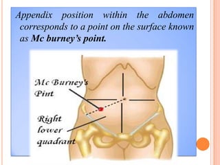 Appendix position within the abdomen
 corresponds to a point on the surface known
 as Mc burney’s point.
 