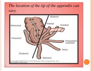  Thelocation of the tip of the appendix can
 vary.
 