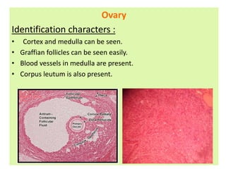 Ovary
Identification characters :
• Cortex and medulla can be seen.
• Graffian follicles can be seen easily.
• Blood vessels in medulla are present.
• Corpus leutum is also present.
 