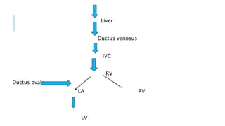 Liver
Ductus venosus
IVC
RV
Ductus ovale
LA RV
LV