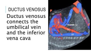 DUCTUS VENOSUS
Ductus venosus
connects the
umbilical vein
and the inferior
vena cava