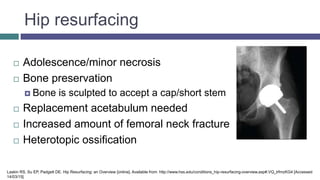Hip resurfacing
 Adolescence/minor necrosis
 Bone preservation
 Bone is sculpted to accept a cap/short stem
 Replacement acetabulum needed
 Increased amount of femoral neck fracture
 Heterotopic ossification
Laskin RS, Su EP, Padgett DE. Hip Resurfacing: an Overview [online]. Available from: http://www.hss.edu/conditions_hip-resurfacing-overview.asp#.VQ_lrfmzKG4 [Accessed
14/03/15]
 