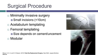 Surgical Procedure
 Minimally invasive surgery
 Small incisions (<10cm)
 Acetabulum templating
 Femoral templating
 Size depends on cement/uncement
 Modular
Marya, S. K. S, and R. K Bawari. (2010) Total Hip Replacement Surgery. New Delhi: Jaypee Brothers
Medical
 
