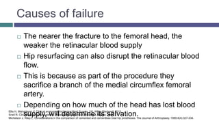 Causes of failure
 The nearer the fracture to the femoral head, the
weaker the retinacular blood supply
 Hip resurfacing can also disrupt the retinacular blood
flow.
 This is because as part of the procedure they
sacrifice a branch of the medial circumflex femoral
artery.
 Depending on how much of the head has lost blood
supply, will determine its salvation.
Ellis H, Mahadevan V. Clinical anatomy. Chichester, West Sussex, UK: Wiley-Blackwell; 2013.
Snell R. Clinical anatomy by systems. Philadelphia: Lippincott Williams & Wilkins; 2007.
Michelson J, Riley L. Considerations in the comparison of cemented and cementless total hip prostheses. The Journal of Arthroplasty. 1989;4(4):327-334.
 