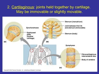 2. Cartilaginous: joints held together by cartilage.
May be immovable or slightly movable.
 