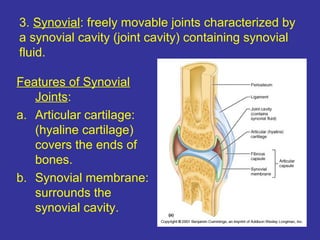 3. Synovial: freely movable joints characterized by
a synovial cavity (joint cavity) containing synovial
fluid.
Features of Synovial
Joints:
a. Articular cartilage:
(hyaline cartilage)
covers the ends of
bones.
b. Synovial membrane:
surrounds the
synovial cavity.
 