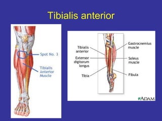 Tibialis anterior
 
