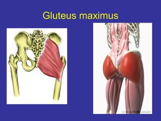 Gluteus maximus
 