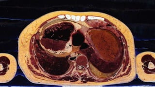 Virtual Dissection Images Anatomy Studio: a Tool for Virtual Dissection Through Augmented 3D ...