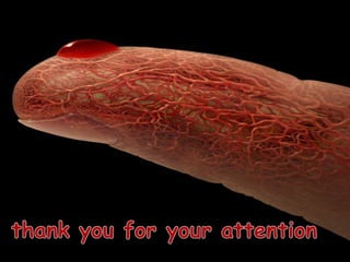 Anatomy superior Mesenteric artery 