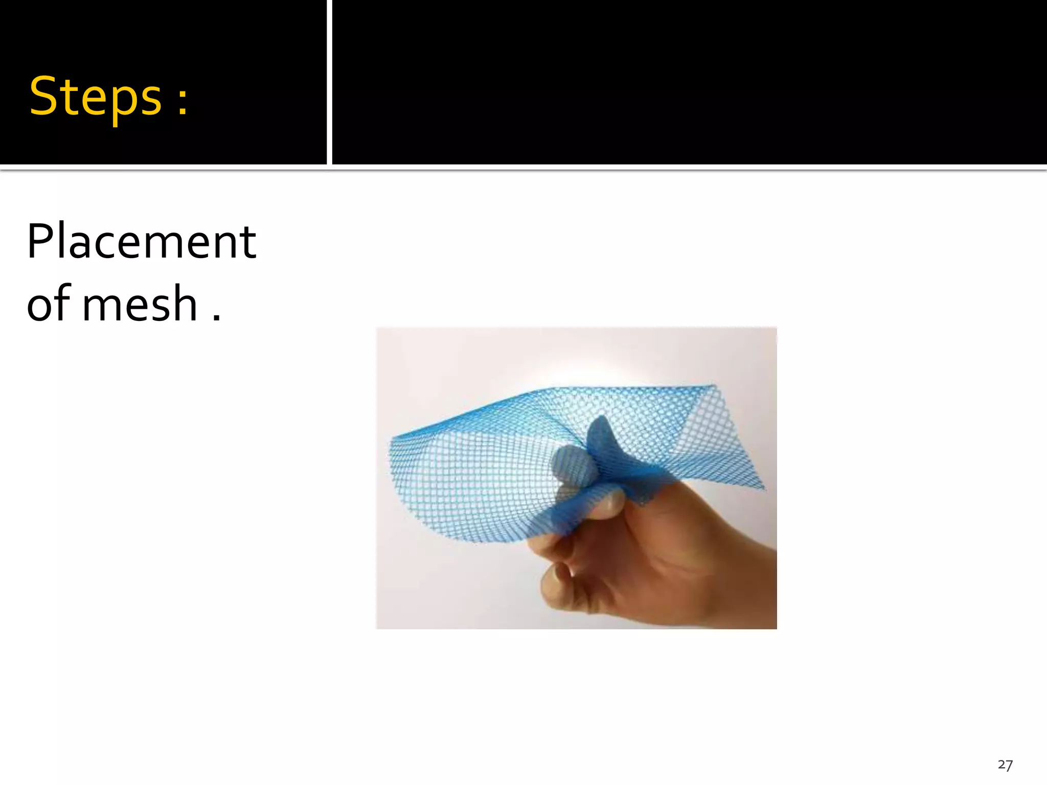 Anatomy Technique Of The Laparoscopic Totally Extra Peritoneal Pptx