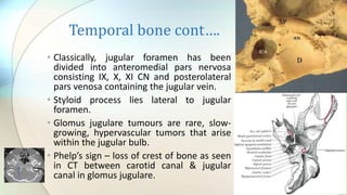 Anatomy temporal bone | PDF