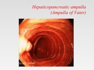 Anatomy the small and large intestine.pptx