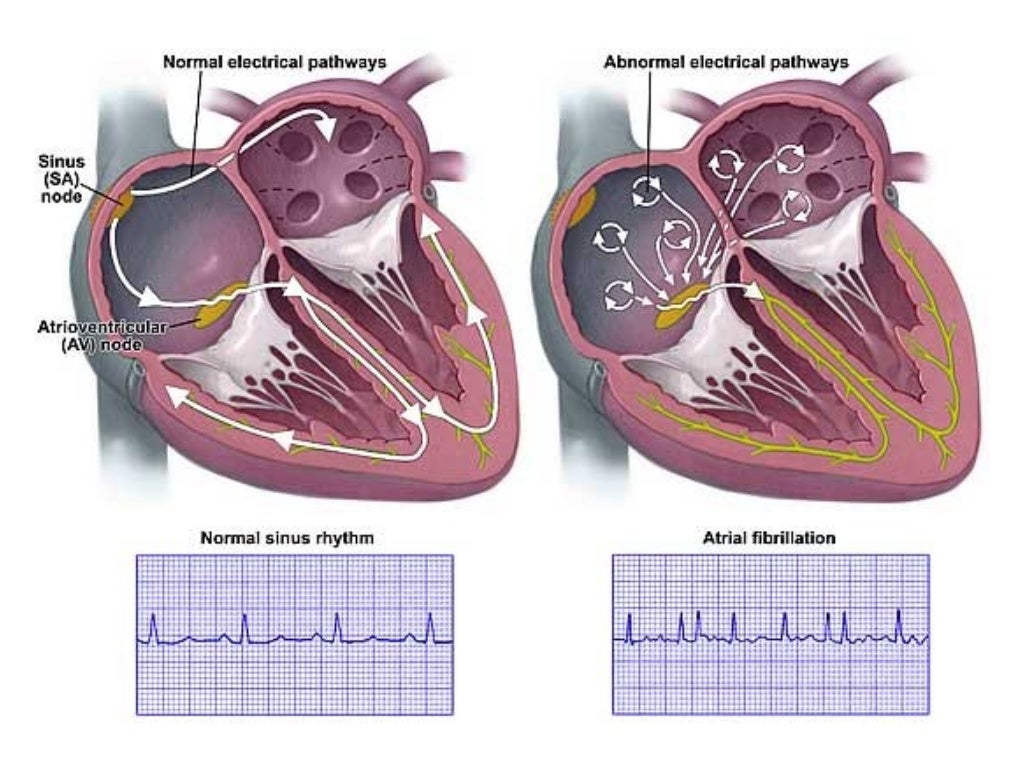 low blood pressure and high heart rate