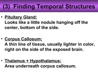 (3) Finding Temporal Structures
• Pituitary Gland:
Looks like a little nodule hanging off the
center, bottom of the side.
• Corpus Callosum:
A thin line of tissue, usually lighter in color,
right on the side of the exposed brain.
• Thalamus + Hypothalamus:
Area underneath corpus callosum.