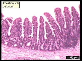 Anatomy Unit 3 Notes:  The Small Intestine