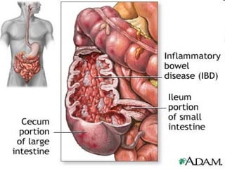 Anatomy Unit 3 Notes:  The Small Intestine