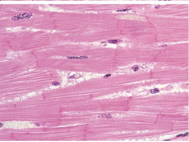 Anatomy Unit 4 Notes: Muscle Types & Parts