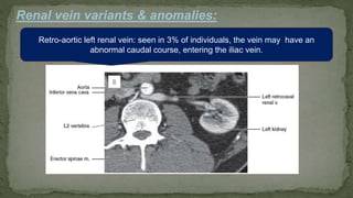Renal vein variants & anomalies:
Retro-aortic left renal vein: seen in 3% of individuals, the vein may have an
abnormal caudal course, entering the iliac vein.
 