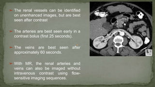 ➢ The renal vessels can be identified
on unenhanced images, but are best
seen after contrast
➢ The arteries are best seen early in a
contrast bolus (first 25 seconds).
➢ The veins are best seen after
approximately 60 seconds.
➢ With MR, the renal arteries and
veins can also be imaged without
intravenous contrast using flow-
sensitive imaging sequences.
 