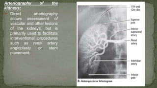 Arteriography of the
kidneys:
➢ Direct arteriography
allows assessment of
vascular and other lesions
of the kidneys, but is
primarily used to facilitate
interventional procedures
such as renal artery
angioplasty or stent
placement.
 