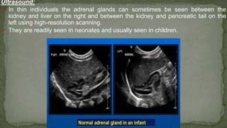 Ultrasound:
➢ In thin individuals the adrenal glands can sometimes be seen between the
kidney and liver on the right and between the kidney and pancreatic tail on the
left using high-resolution scanning.
➢ They are readily seen in neonates and usually seen in children.
 