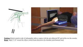 Shoulder Position Anatomy and xrays of shoulder joint | PPTX