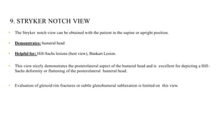 Anatomy and xrays of shoulder joint | PPTX