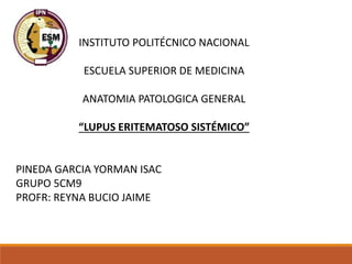 INSTITUTO POLITÉCNICO NACIONAL
ESCUELA SUPERIOR DE MEDICINA
ANATOMIA PATOLOGICA GENERAL
“LUPUS ERITEMATOSO SISTÉMICO”
PINEDA GARCIA YORMAN ISAC
GRUPO 5CM9
PROFR: REYNA BUCIO JAIME
 