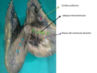 Cintilla arciforme



tabique interventricular




Pilares del ventrículo derecho
 