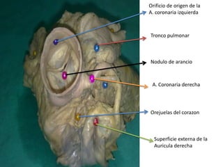 Orificio de origen de la
A. coronaria izquierda



Tronco pulmonar



Nodulo de arancio



 A. Coronaria derecha




Orejuelas del corazon



  Superficie externa de la
  Auricula derecha
 