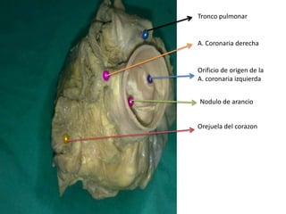 Tronco pulmonar


A. Coronaria derecha


Orificio de origen de la
A. coronaria izquierda


Nodulo de arancio


Orejuela del corazon
 