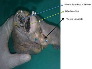 Válvula del tronco pulmonar

Válvula aortica


  Válvula tricuspide
 