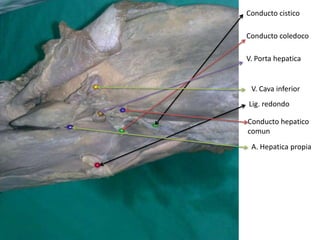 Conducto cistico

Conducto coledoco

V. Porta hepatica


 V. Cava inferior
Lig. redondo

Conducto hepatico
comun
 A. Hepatica propia
 