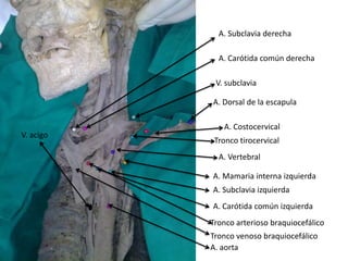 A. Subclavia derecha

             A. Carótida común derecha

            V. subclavia

           A. Dorsal de la escapula

              A. Costocervical
V. acigo
            Tronco tirocervical
             A. Vertebral

           A. Mamaria interna izquierda
           A. Subclavia izquierda
           A. Carótida común izquierda
           Tronco arterioso braquiocefálico
           Tronco venoso braquiocefálico
           A. aorta
 