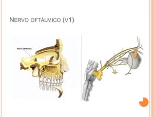 NERVO OFTÁLMICO (V1) 
 