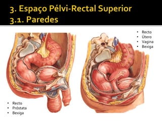 • Recto 
• Próstata 
• Bexiga 
• Recto 
• Útero 
• Vagina 
• Bexiga 
 