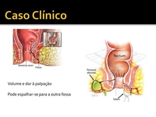 Volume e dor à palpação 
Pode espalhar-se para a outra fossa 
 