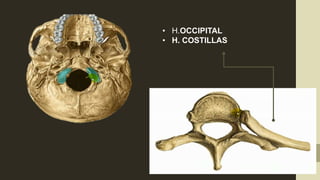 • H.OCCIPITAL
• H. COSTILLAS
 